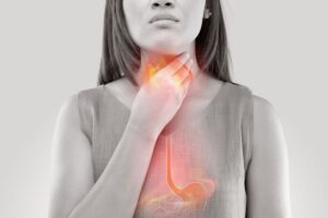 GERD Mematikan? Dokter Ungkap Fakta Mengejutkan Penyebab Kematian Mendadak